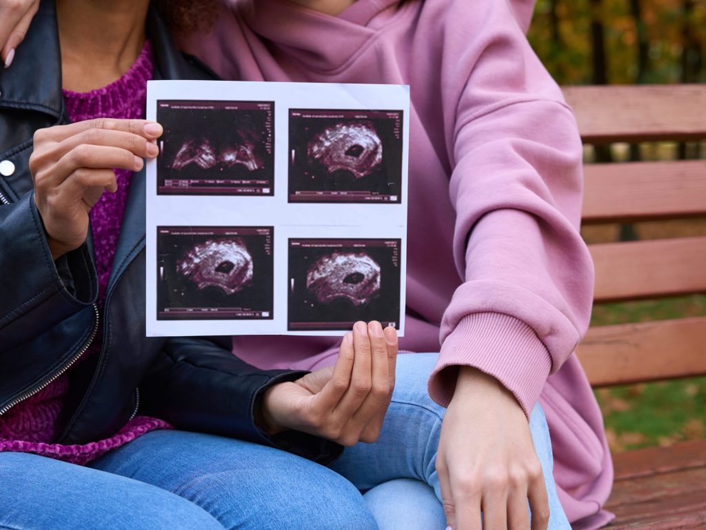 signs of pregnancy
